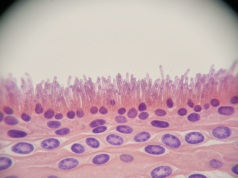 Síndrome del intestino permeable